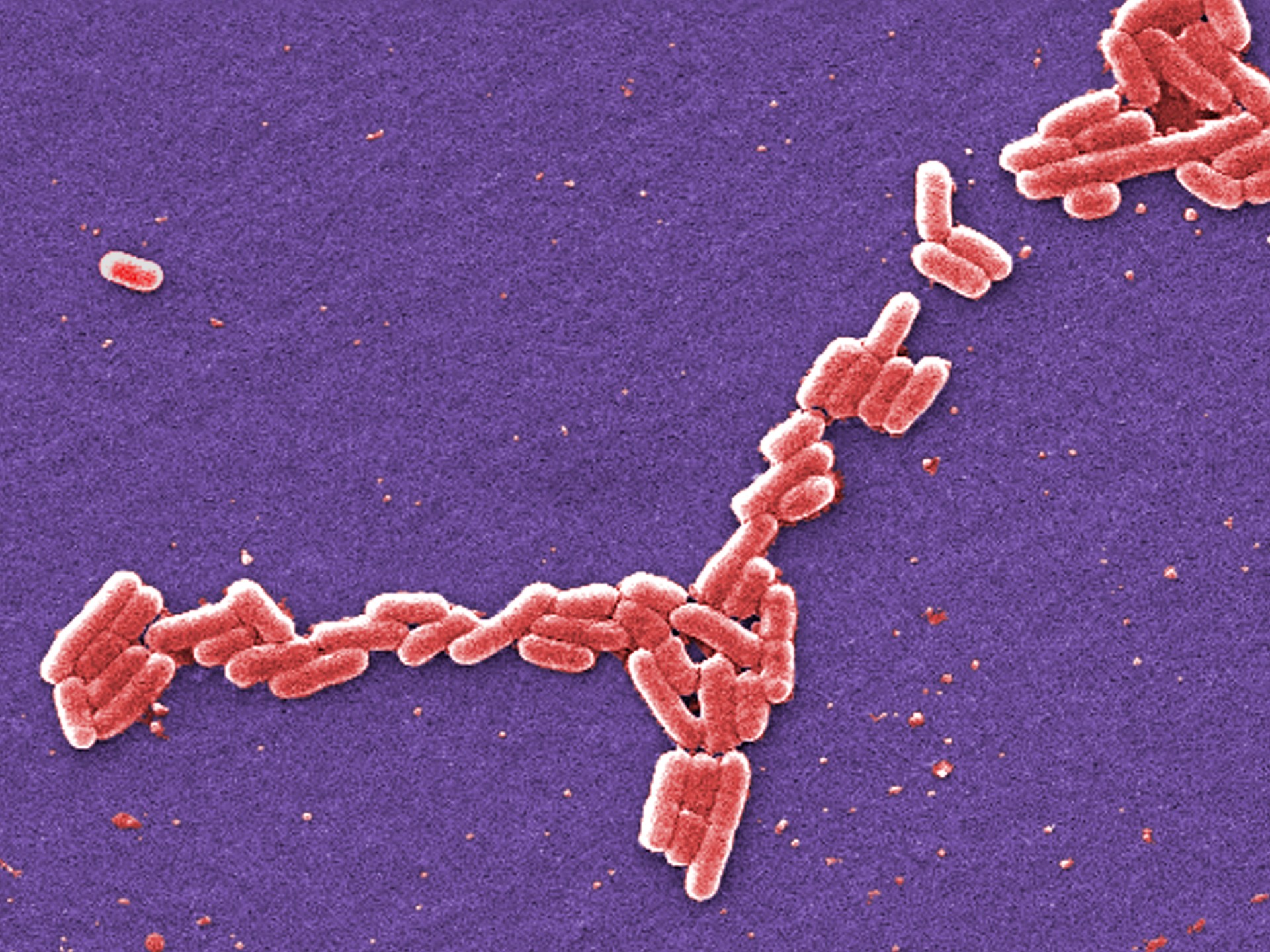 Why was ground beef recalled in the US over possible E coli contamination? | Explainer News